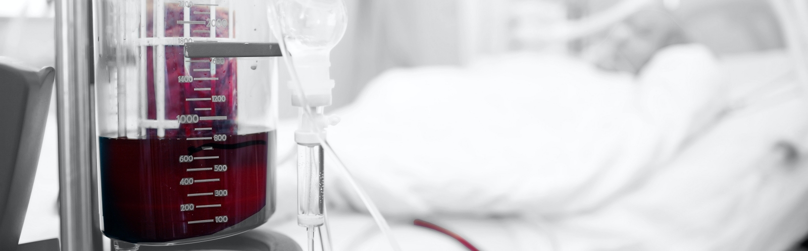 Blood collection equipment near the patient bed in the critical