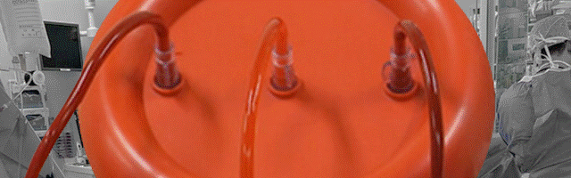 red blood cell washing