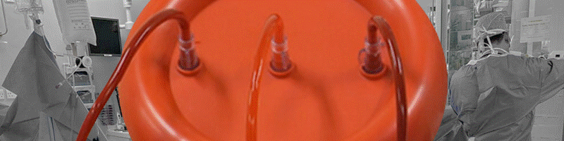 red blood cell washing